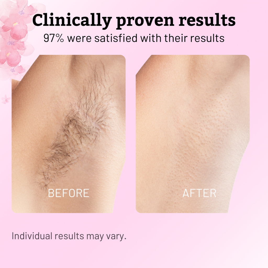 Caramela Beauty Cyperus Rotundus Oil for Natural Permanent Hair Reduction-Shop